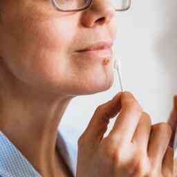 So erkennen und behandeln Sie einen beginnenden Lippenherpes Die