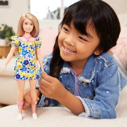 Die neue Barbie hat das Down Syndrom und muss Stigmatisierung bekaempfen