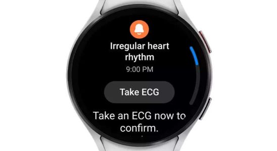 Samsung bringt bald Herzrhythmus Benachrichtigungsfunktion auf die Galaxy Watch Das bedeutet