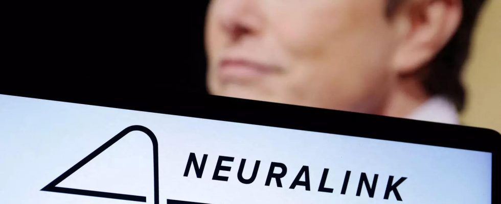 Elon Musks Neuralink rekrutiert jetzt Menschen um seine Gehirnchips auszuprobieren