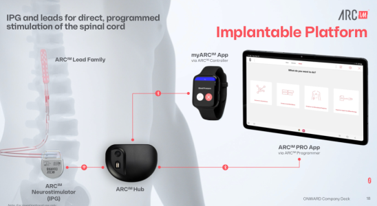 Diese Wirbelsaeulenimplantattechnologie koennte die Mobilitaet von Parkinson Patienten wiederherstellen