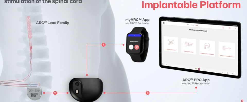 Diese Wirbelsaeulenimplantattechnologie koennte die Mobilitaet von Parkinson Patienten wiederherstellen