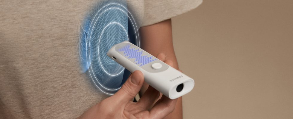 Das neue Multiscope Geraet von Withings prueft die Vitalwerte bei telemedizinischen