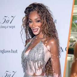 Model Winnie Harlow ist froh dass ihre Hautkrankheit Vitiligo jetzt