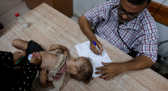 Gaza Poliovirus Typ 2 laehmt Baby in Gaza UN fordert