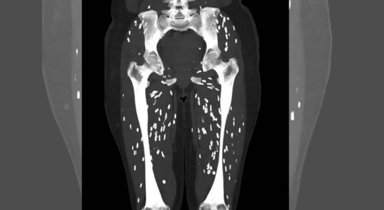 Google „Einer der verruecktesten CT Scans Arzt teilt Bilder von mit