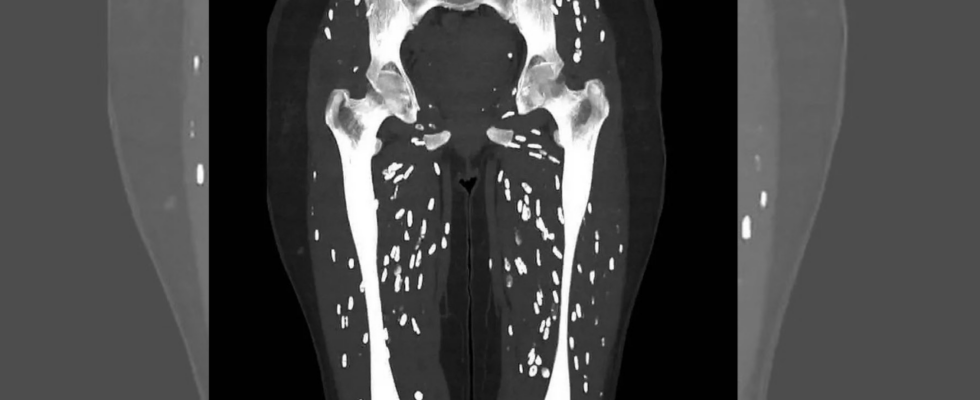 Google „Einer der verruecktesten CT Scans Arzt teilt Bilder von mit