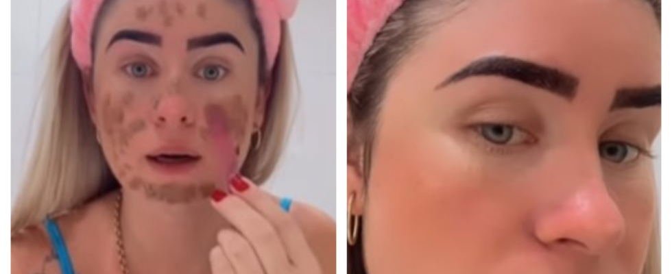 Keine wissenschaftliche Grundlage Die Kot Gesichtsmaske einer brasilianischen Influencerin stoesst bei