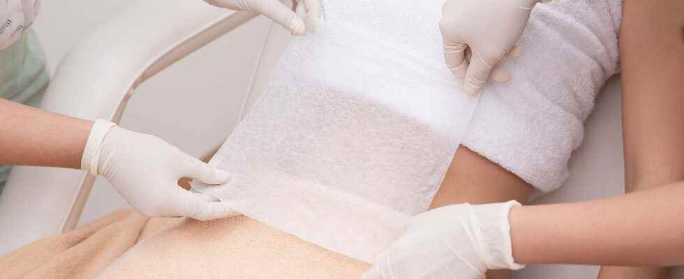 Cryolipolysis what is it