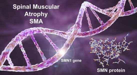 How is premarital SMA screening done Hospitals that screen for