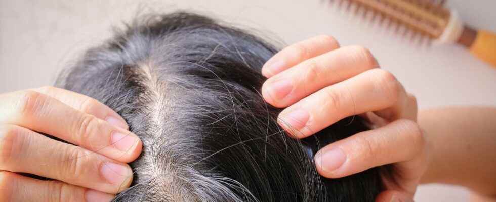 How to prevent hair loss