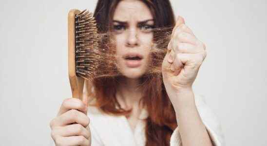 If your hair is shedding 100 strands a day beware