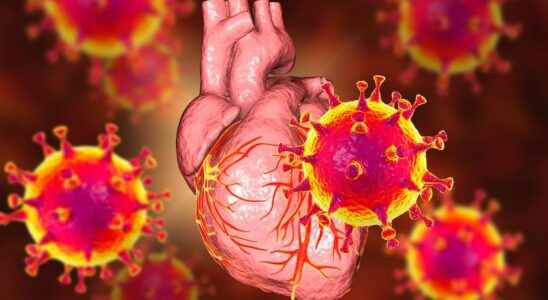 Covid 19 and myocarditis what do the numbers say