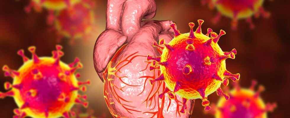 Covid 19 and myocarditis what do the numbers say