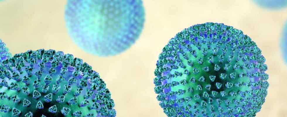 Epstein Barr virus responsible for multiple sclerosis