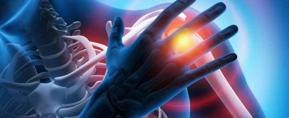 Osteoarthritis origin and treatment of osteoarthritis