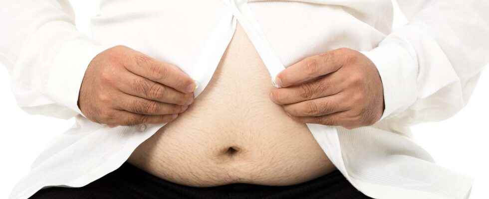 Thanks to their genes some obese people are relatively healthy