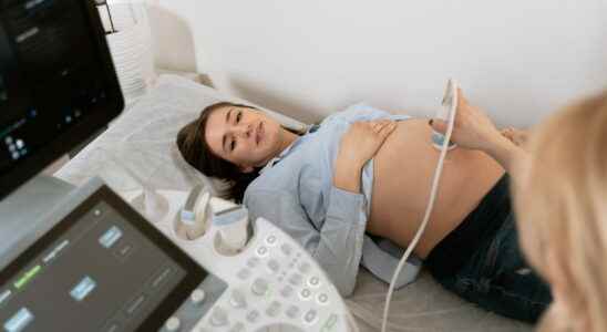 4 tips before going to your pregnancy ultrasound