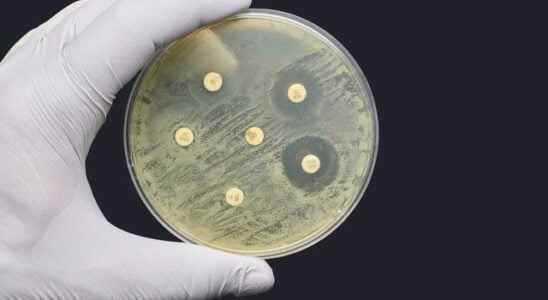 Antibiotic resistant bacteria killed more than 1 million people in 2019