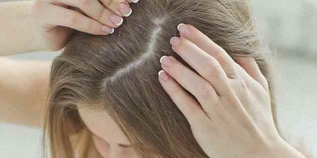 Dandruff problem becomes history thanks to homemade