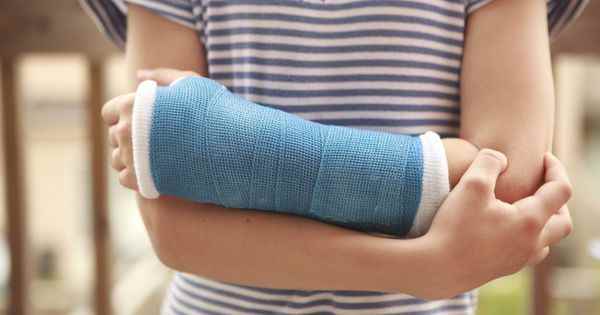 Fractures better identify them thanks to artificial intelligence