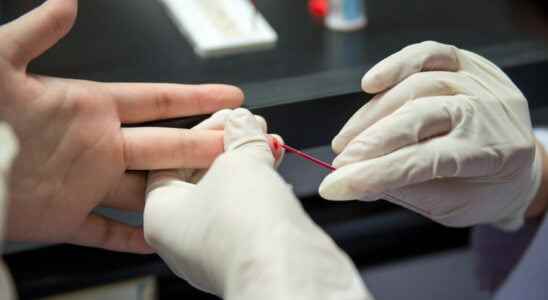 HIV screening test free and without a prescription in the