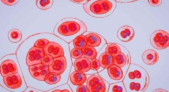 HIV what is this newly discovered more transmissible variant