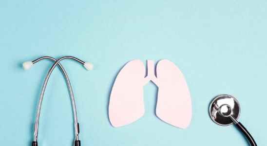 Lung cancer screening in France soon to be generalized