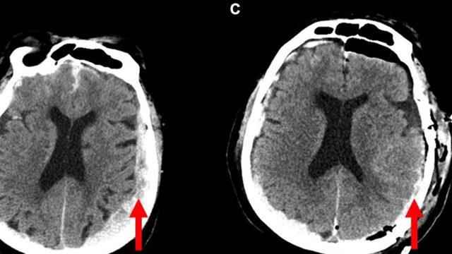 The results were astonishing Brain activity continued despite death