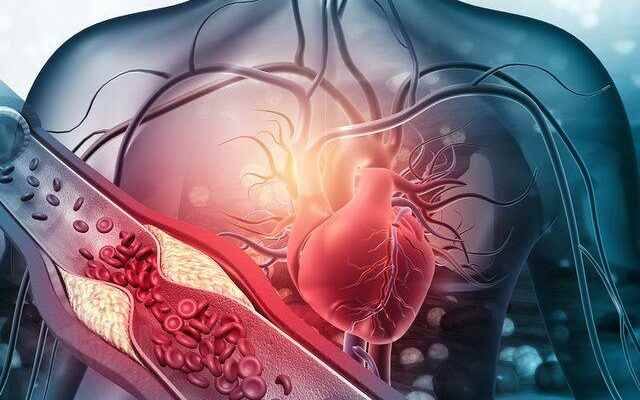 Watch out for these signs You can have cholesterol…