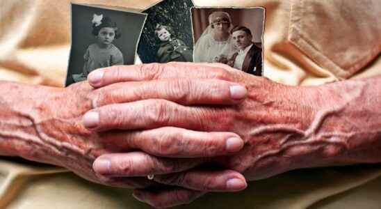 Alzheimers disease what factors influence life expectancy