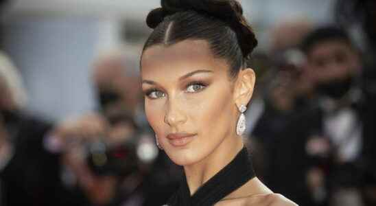 Bella Hadid regrets her rhinoplasty at age 14