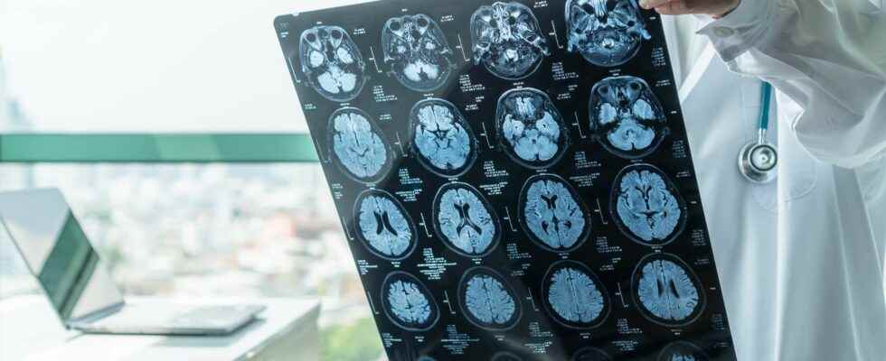 Brain week towards faster diagnosis of psychiatric diseases thanks to