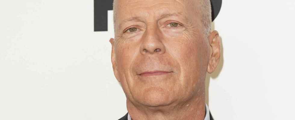 Bruce Willis what is aphasia a disease that led him