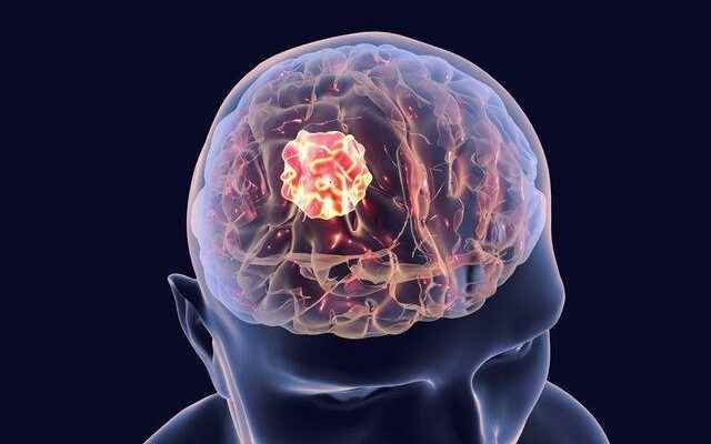 Pandemic threatens brain health These signals cannot be ignored