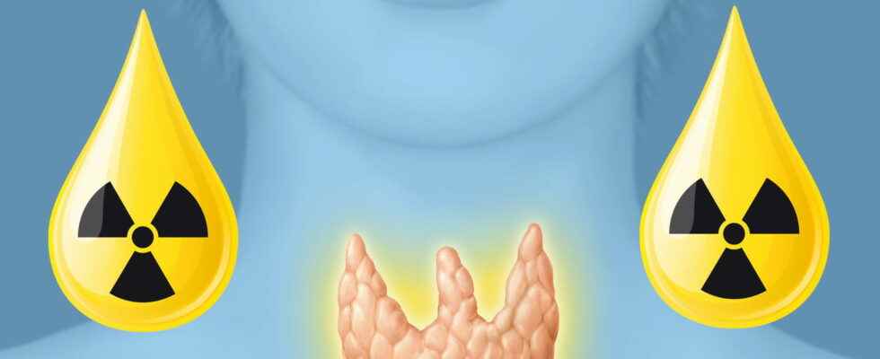 Radioactive iodine risks what danger for the thyroid