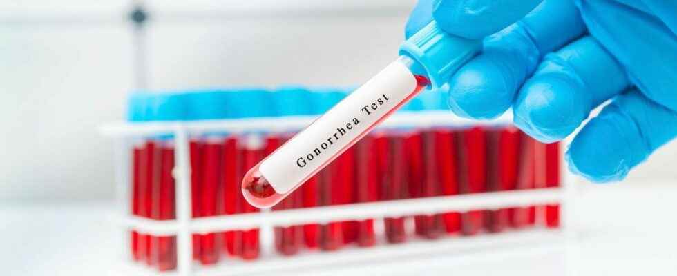 Gonorrhea effective meningitis vaccines to prevent it