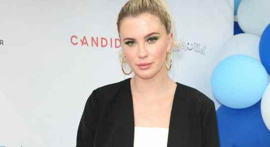 Ireland Baldwin responds to her criticized chin lift