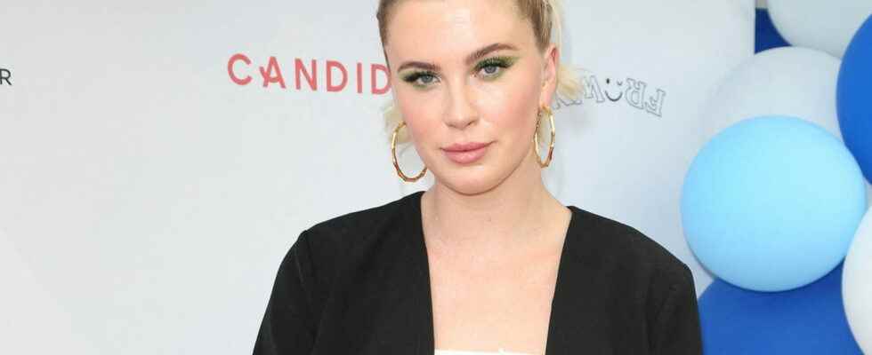 Ireland Baldwin responds to her criticized chin lift