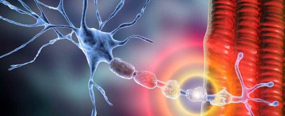 Multiple sclerosis stopped thanks to immune cells directed against the