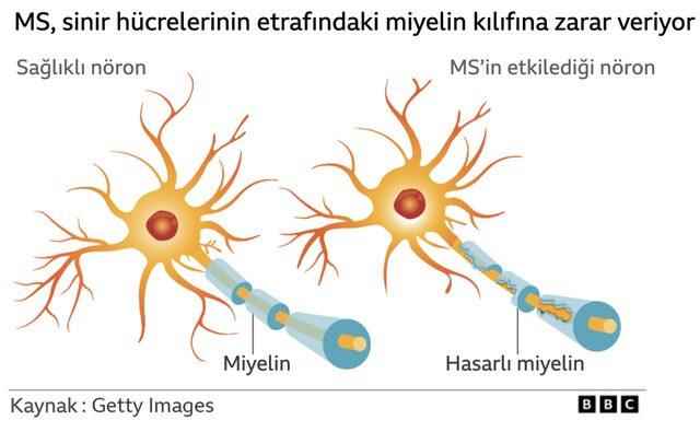 neuron