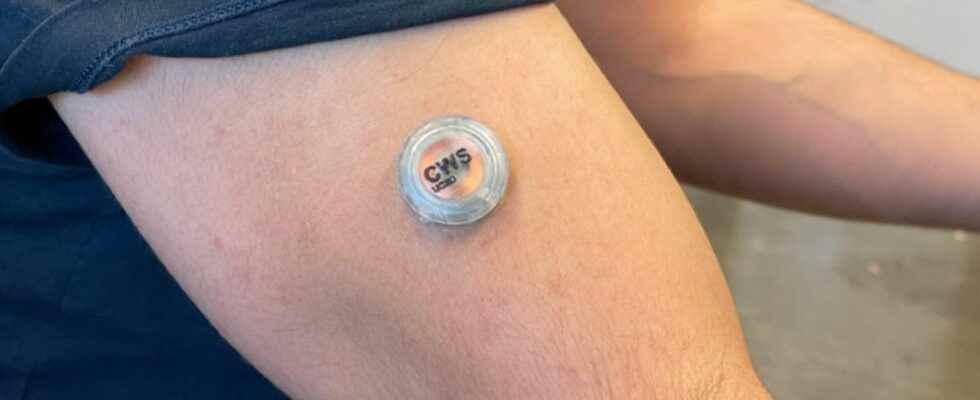 A mini sensor on the arm measures glucose alcohol and lactate