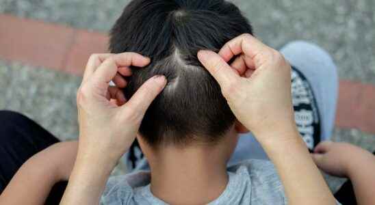 Bizarre Patient Strange Fluorescent Blue Pimples Appear On Childs Skull