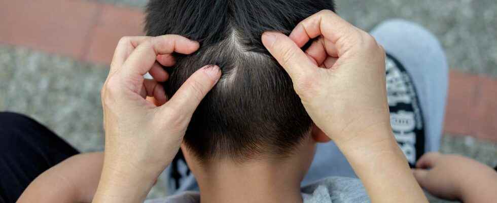 Bizarre Patient Strange Fluorescent Blue Pimples Appear On Childs Skull