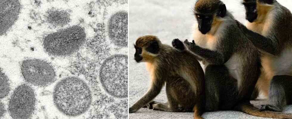 Monkey pox and Monkeypox detected in Spain Portugal UK USA