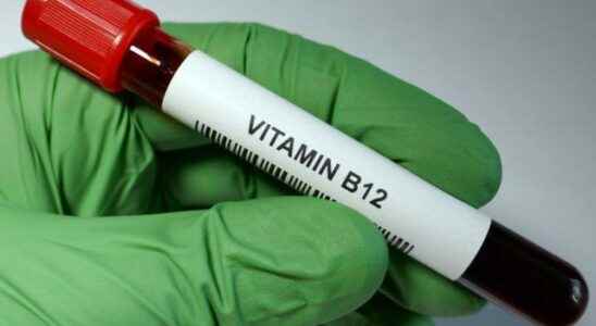 What is good for B12 deficiency What are the natural