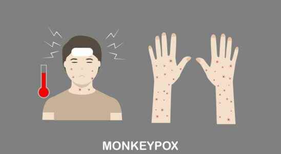 In what order do the symptoms of monkeypox appear