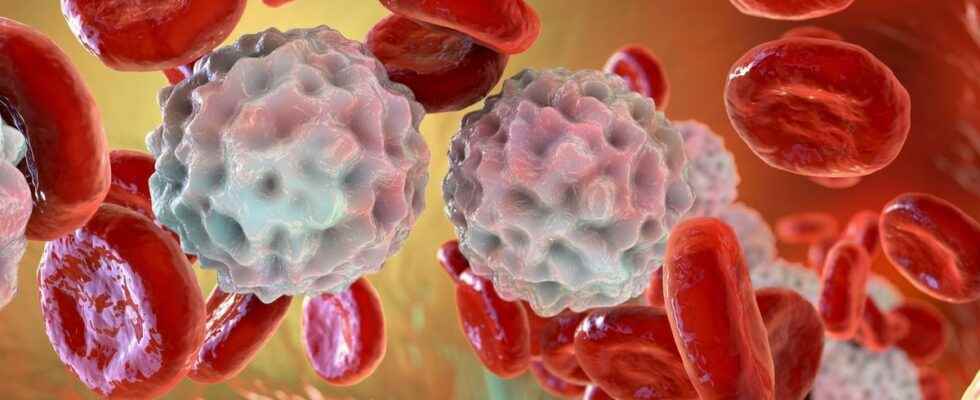 Mantle cell lymphoma a new treatment for patients