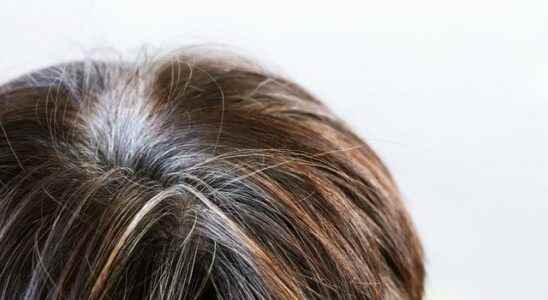 Miraculous potions that will make graying hair history Ibn Sina