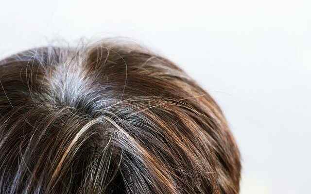 Miraculous potions that will make graying hair history Ibn Sina